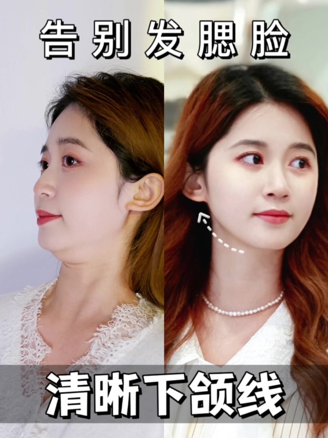 变美邀请已经发出✉️ get同款高级侧颜✨方圆脸逆袭鹅蛋脸!