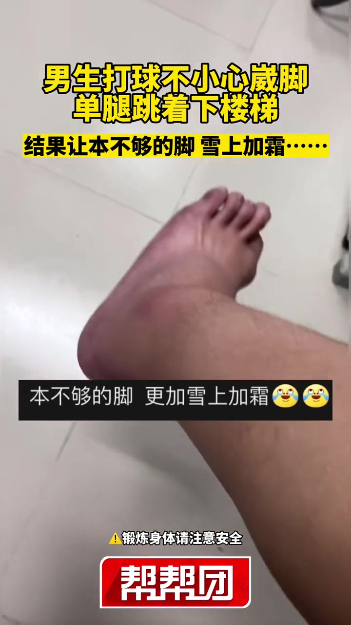 看着都疼!男子崴脚后单腿下楼梯,结果崴完右脚崴左脚
