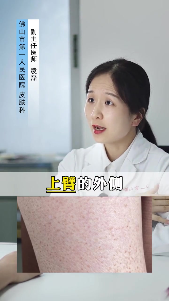 腿上长的这种小颗粒,到了夏天特别难看,教你这样解决