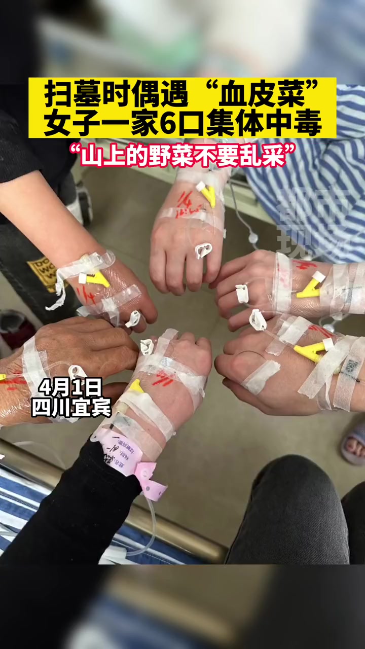 扫墓时偶遇“血皮菜”,女子一家6口集体中毒 化儿草 野菜 清明