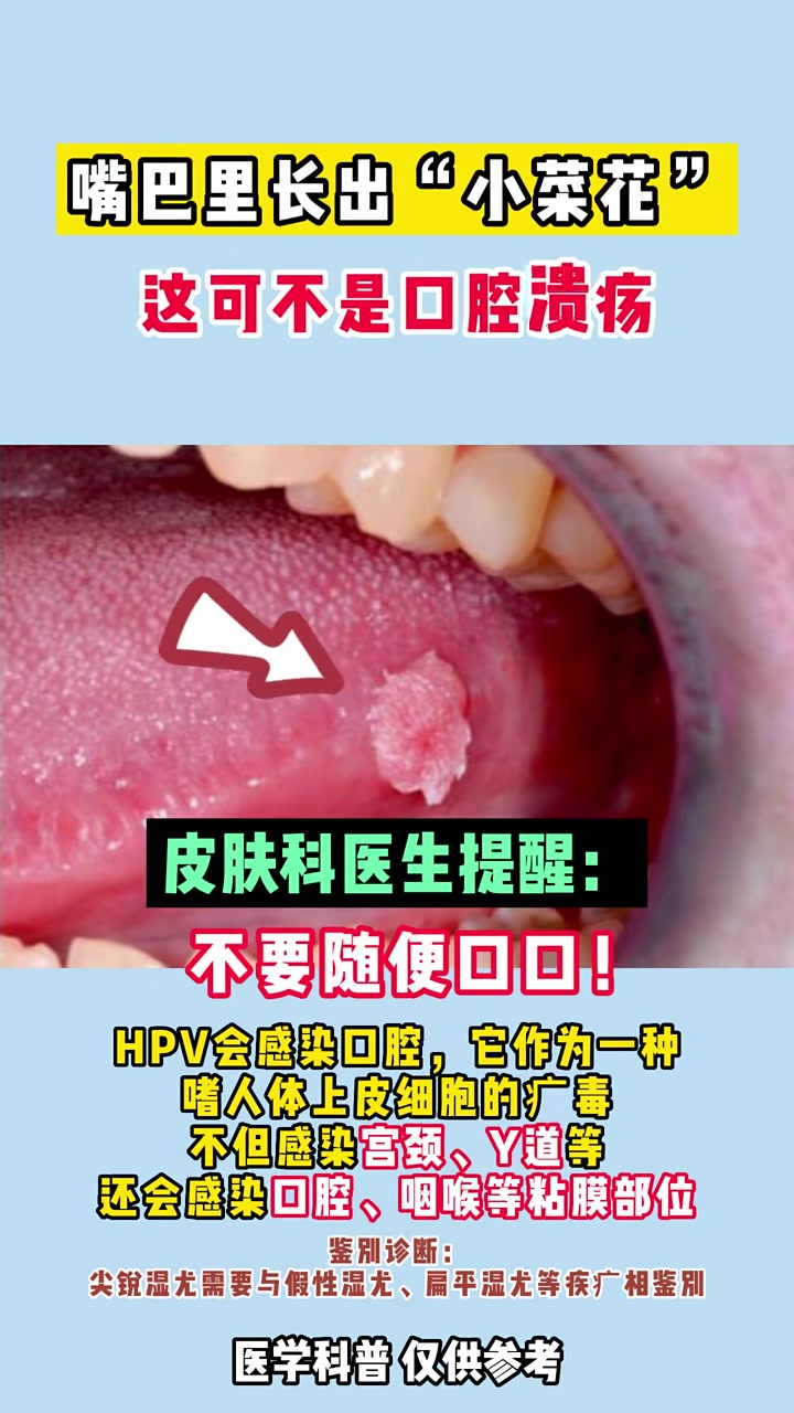 嘴巴里长出小菜花