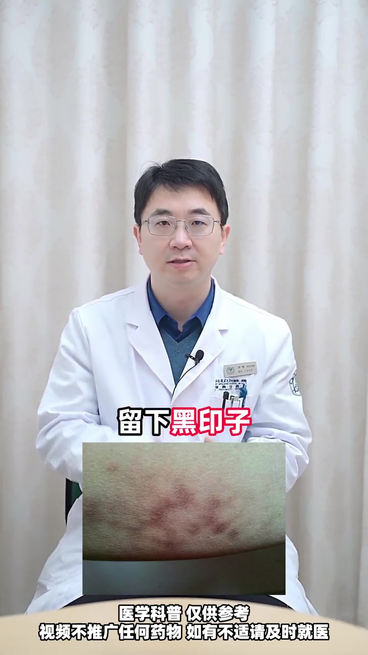 大腿内侧黑,快速变白自救指南来了!股癣 湿疹 皮肤健康