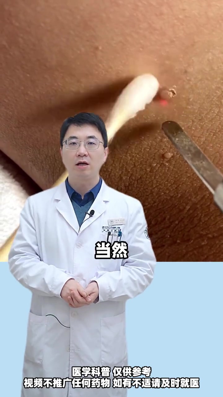 你脖子上的小肉丁,当心是hpv的警告!丝状疣 健康 hpv