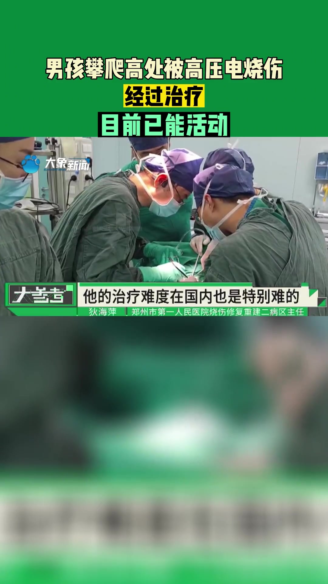 河南郑州:男孩攀爬高处,被高压电烧伤,经过治疗,目前已能活动