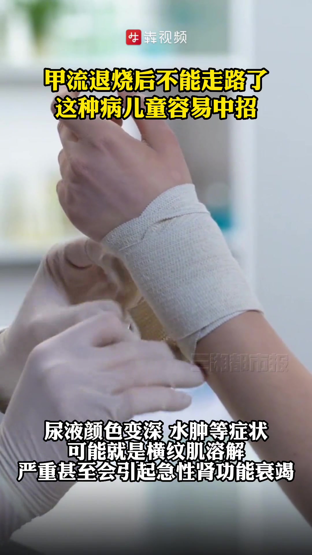 甲流退烧后竟然不能走路了?这种病儿童容易中招