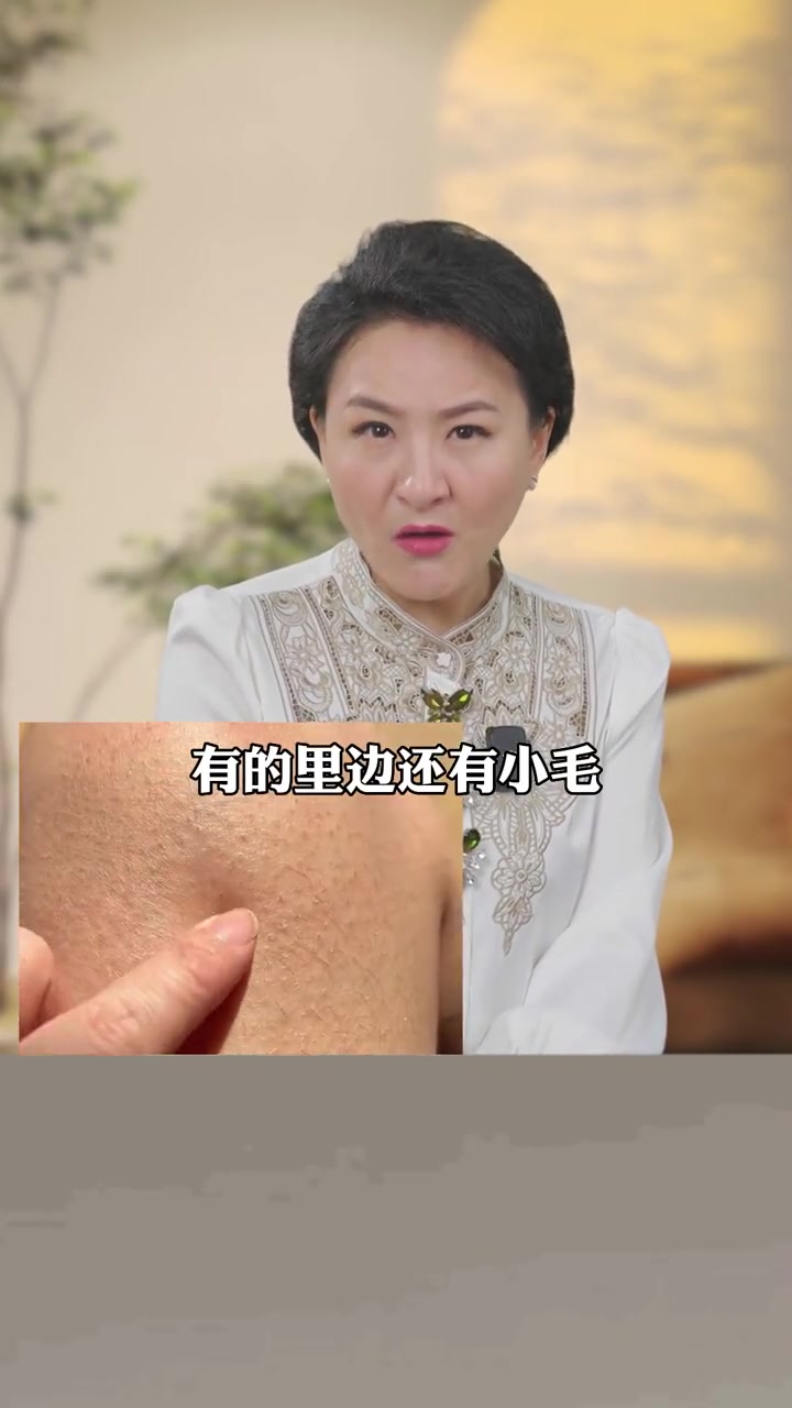 夏天马上来了,有鸡皮肤的宝贝们,给自己用上这个维E尿素霜。鸡皮肤 维E尿素霜 护肤