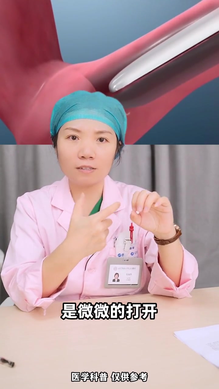 女生千万不要因为害怕鸭嘴钳,就躲开妇科检查,不然你就亏大了 医学科普 关爱女性健康 医疗小