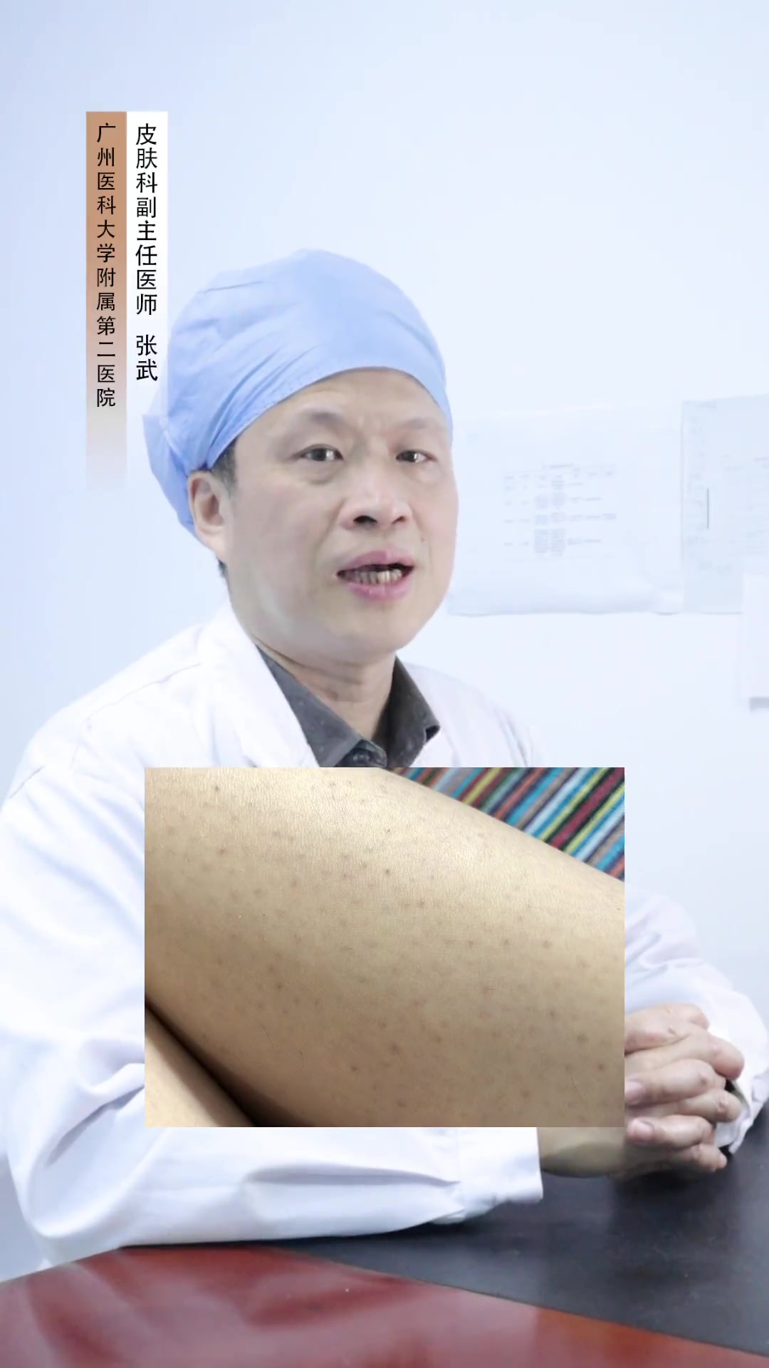 鸡皮肤处理起来也很简单,这个方法请记住