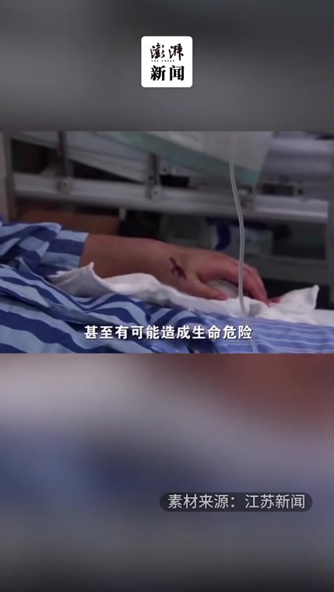 男子捞魔鬼鱼被刺伤,称比断指还疼