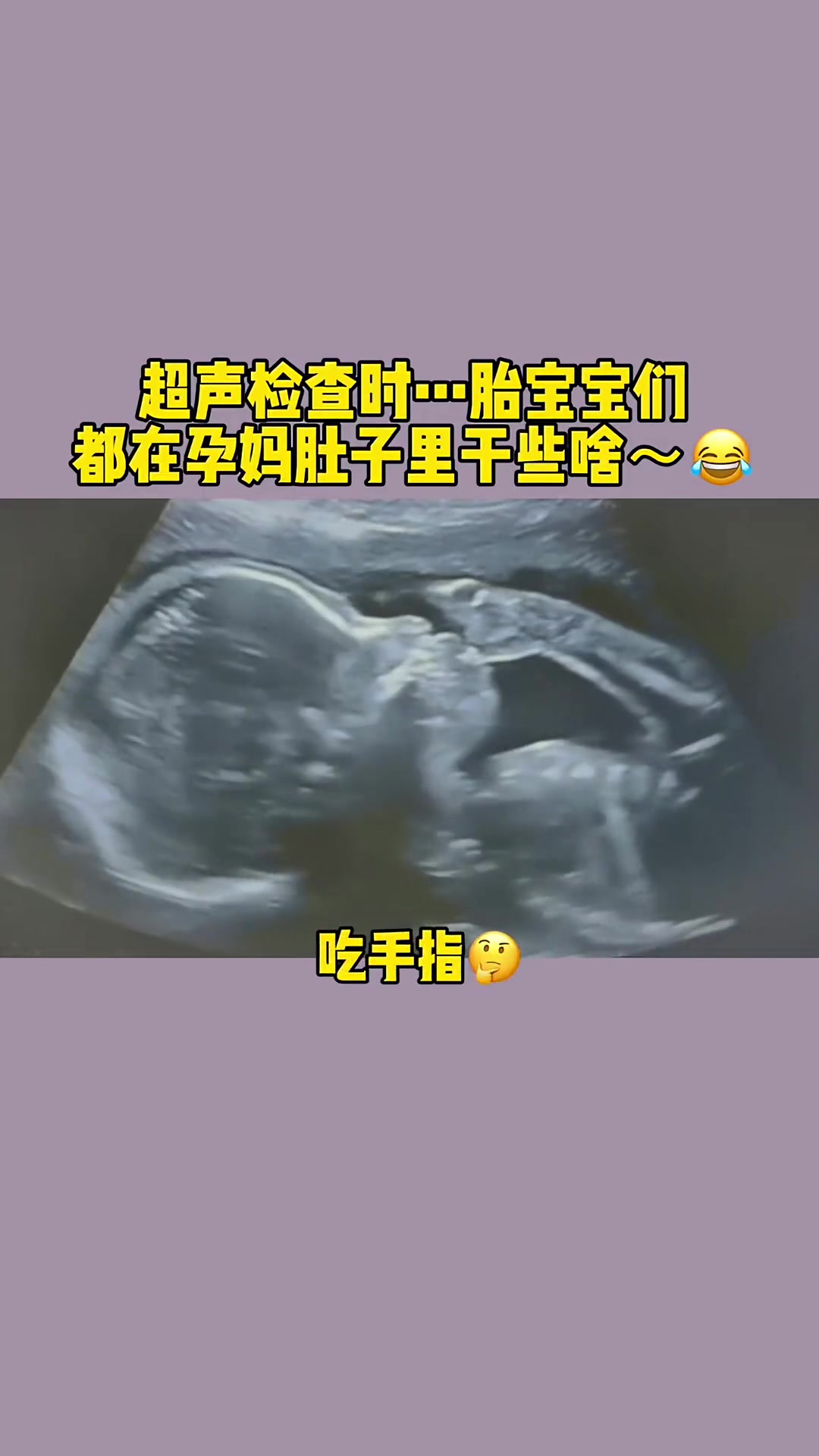 你还以为太宝宝无聊吗……其实她有好多事情做 产检一路绿灯 四维彩超 传好孕 胎动 玩脐带 