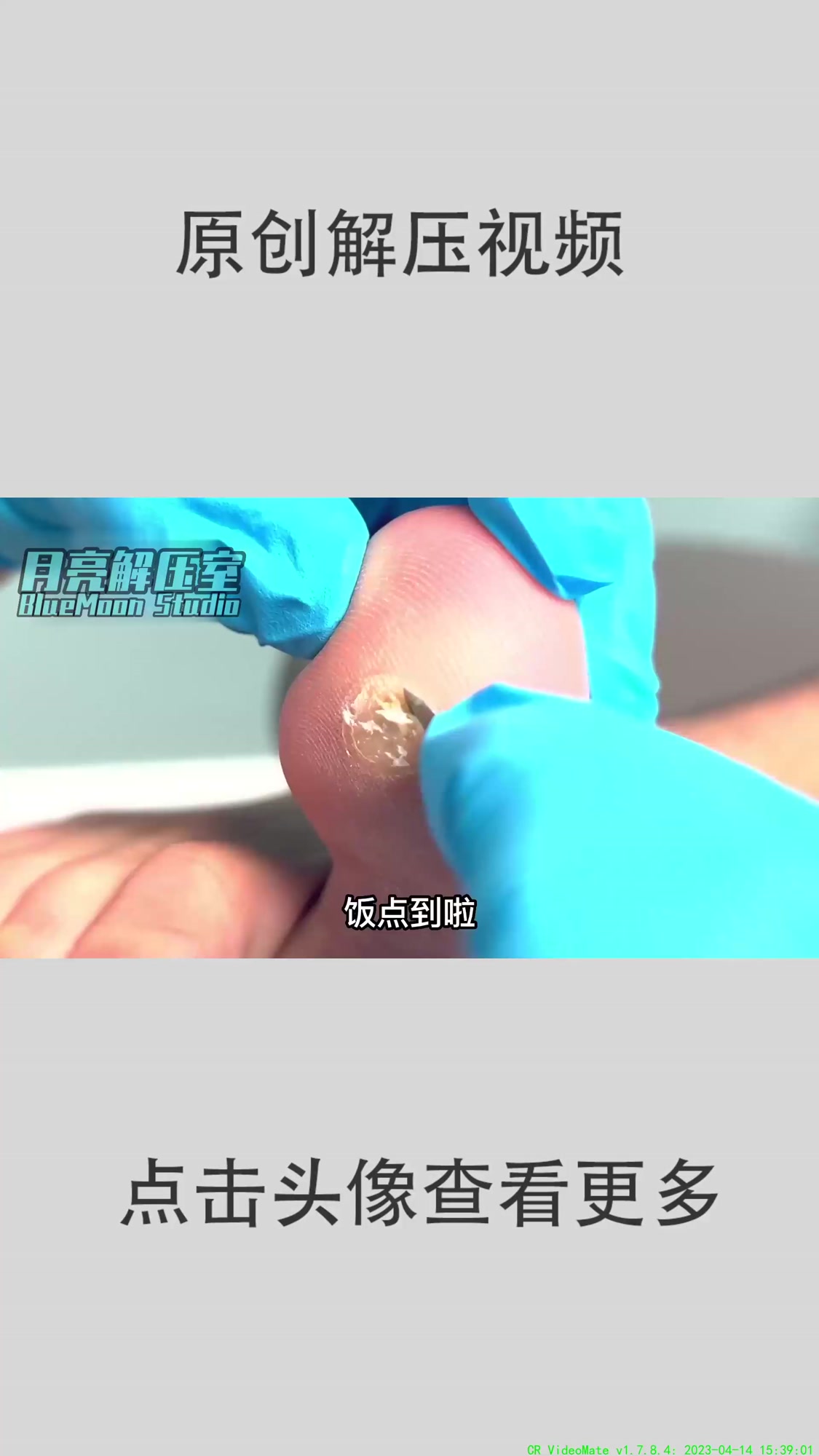 香脚牛奶???? 修脚 解压 强迫症 鸡眼
