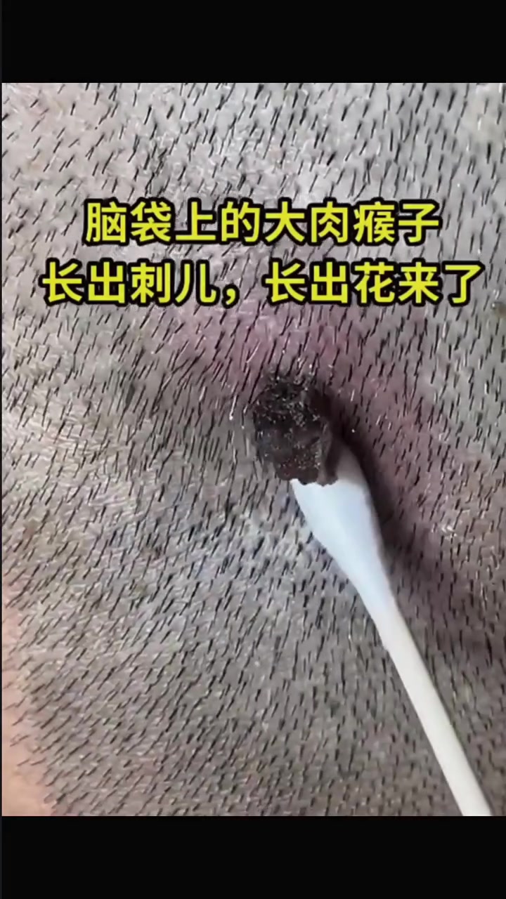 分享视频