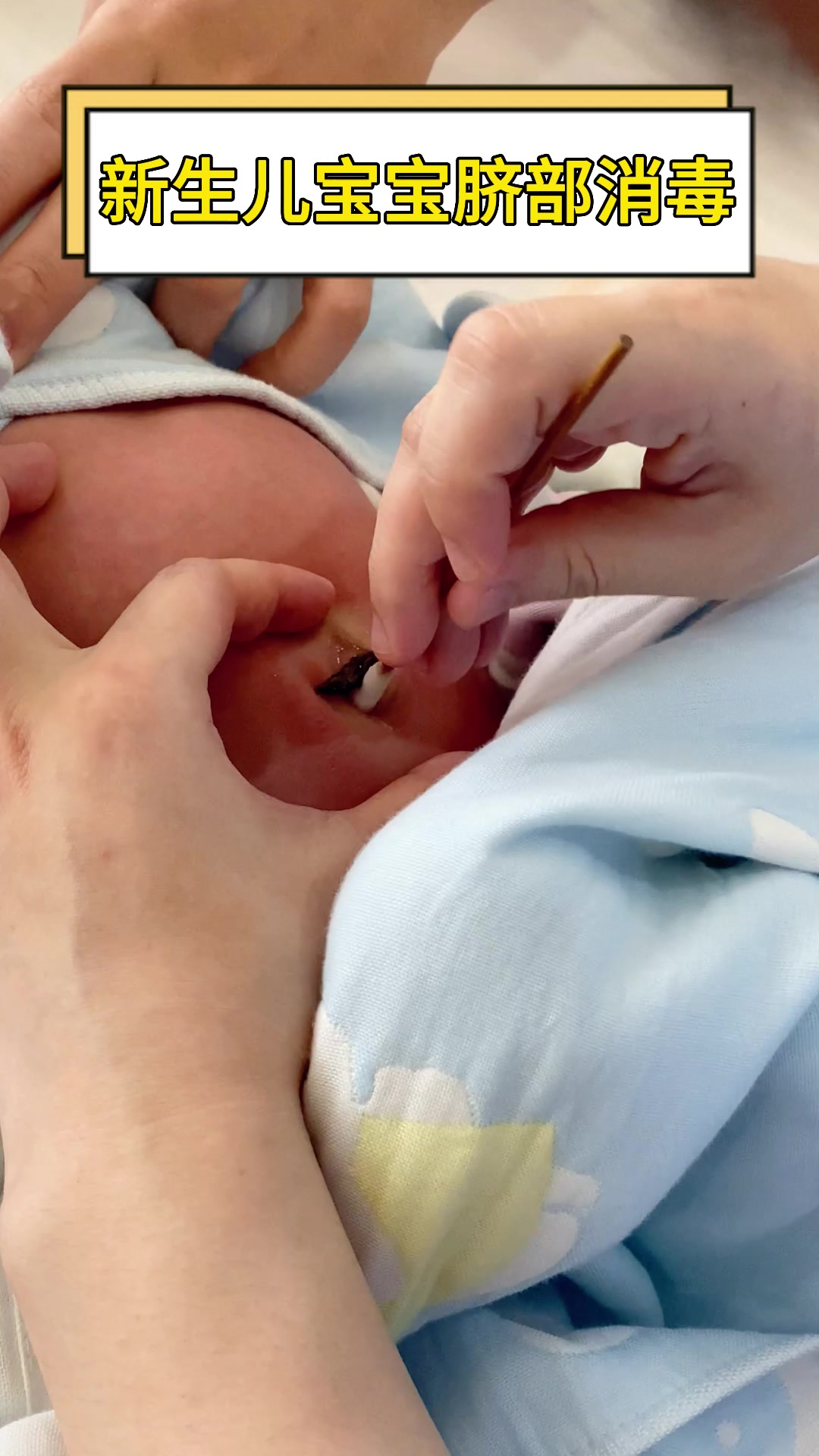新生宝宝肚脐如何护理?这些注意事项快记起来