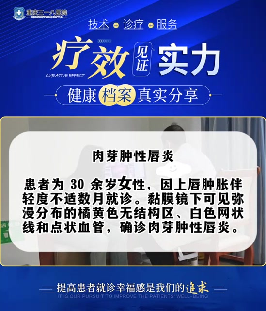 重庆三一八医院尚玉山医生讲解唇炎