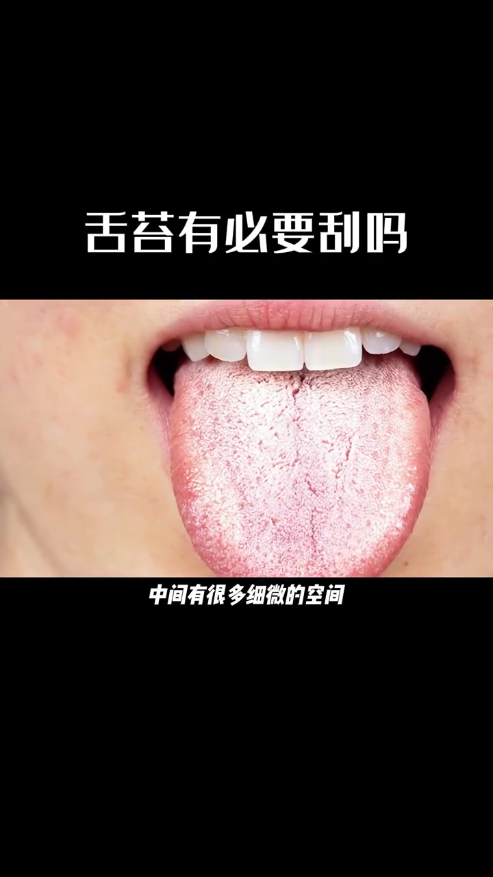 第10集|原来舌苔是这样清理的,我以前都不知道 口腔健康 科普 爱牙护牙 921好物节 舌