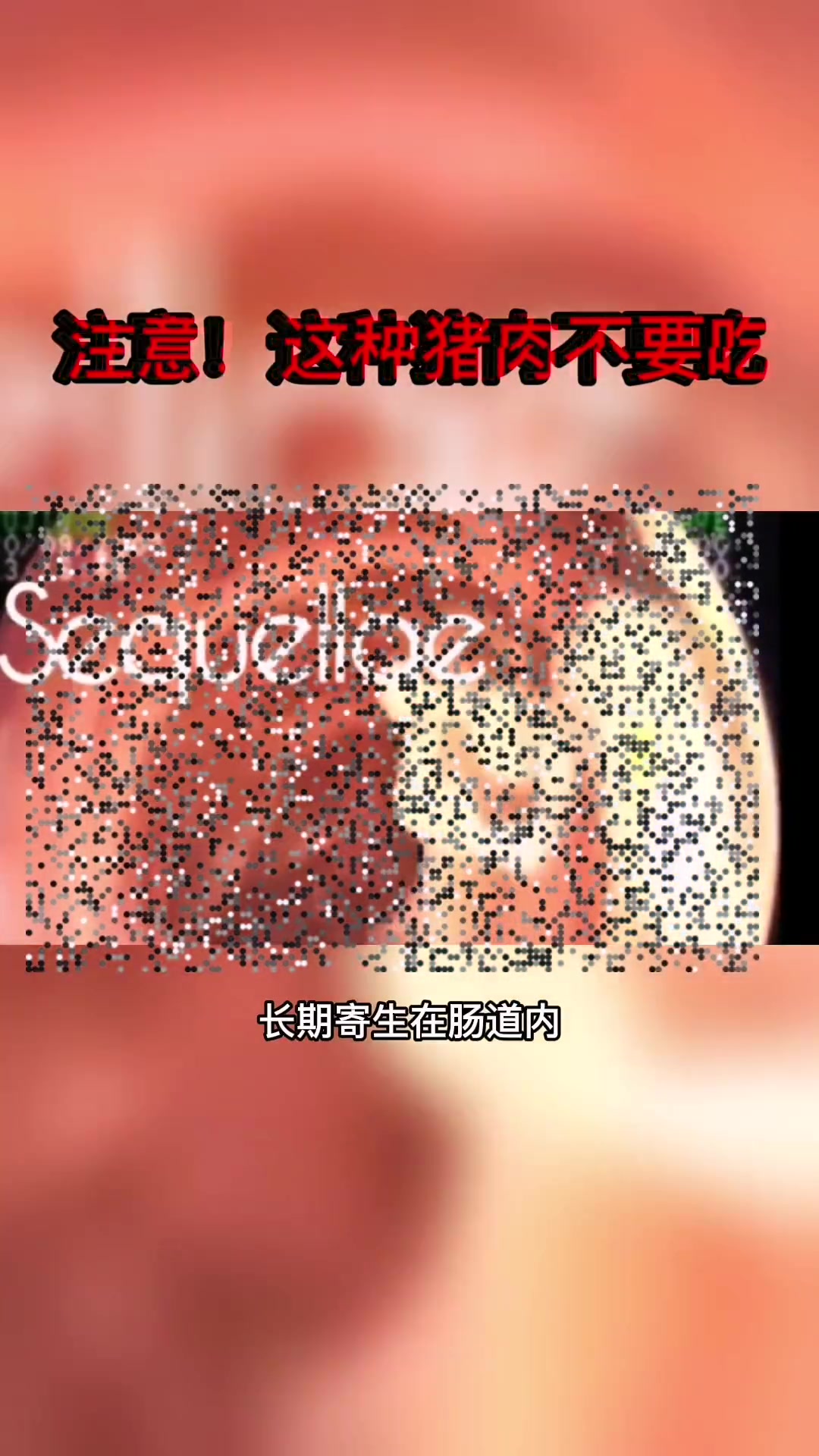 米猪肉不要吃,当心感染寄生虫,而且肉类的食物烹饪熟哦,尤其是火锅不要急着吃,鸭肠啊牛肉啊要