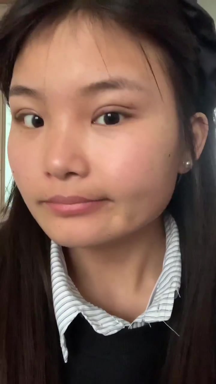 埋线双眼皮恢复记录,每天的随拍,双眼皮能看出来消肿了不少!