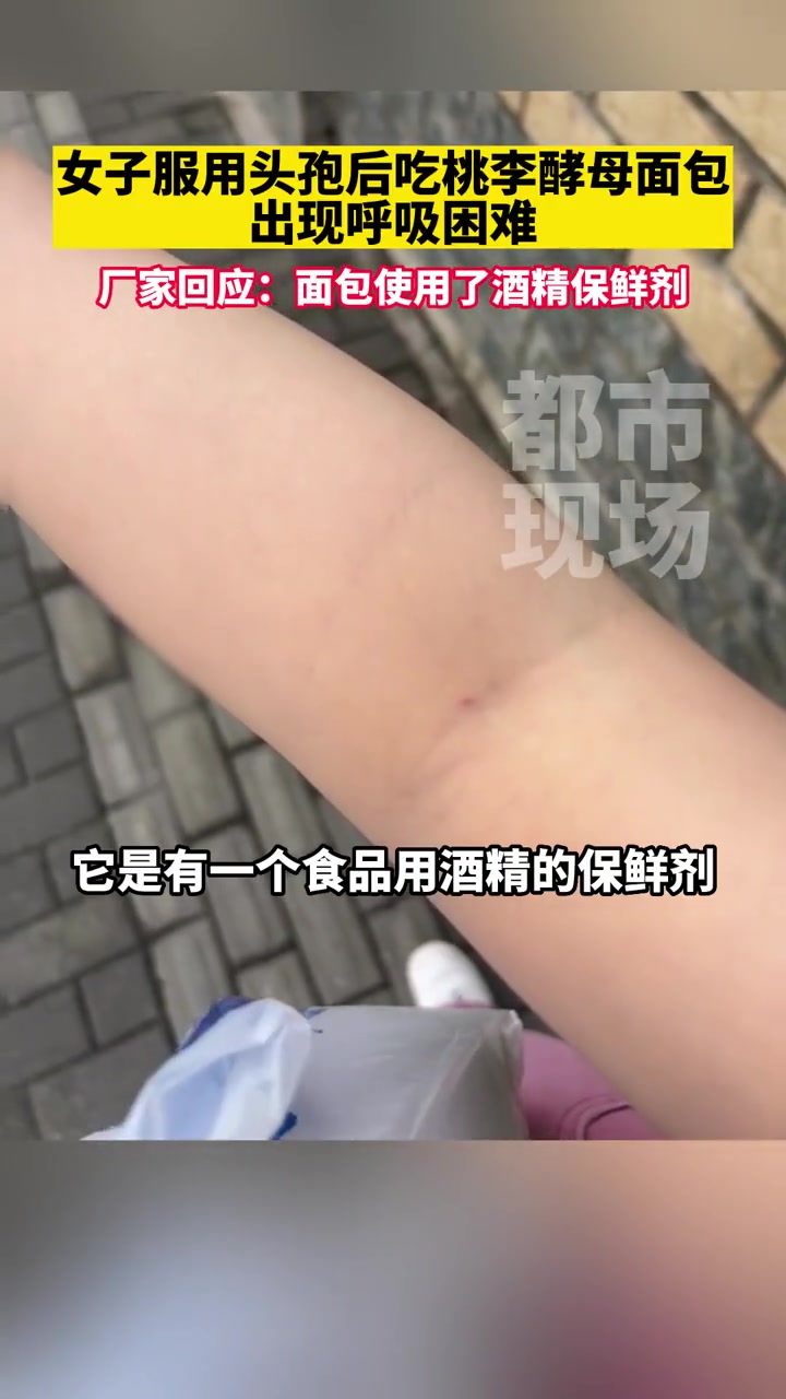 女子服用头孢后吃桃李酵母面包出现呼吸困难,厂家回应 上海 桃李酵母面包 过敏现象 爆料入口