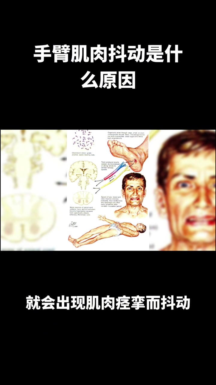 手臂肌肉抖动是什么原因