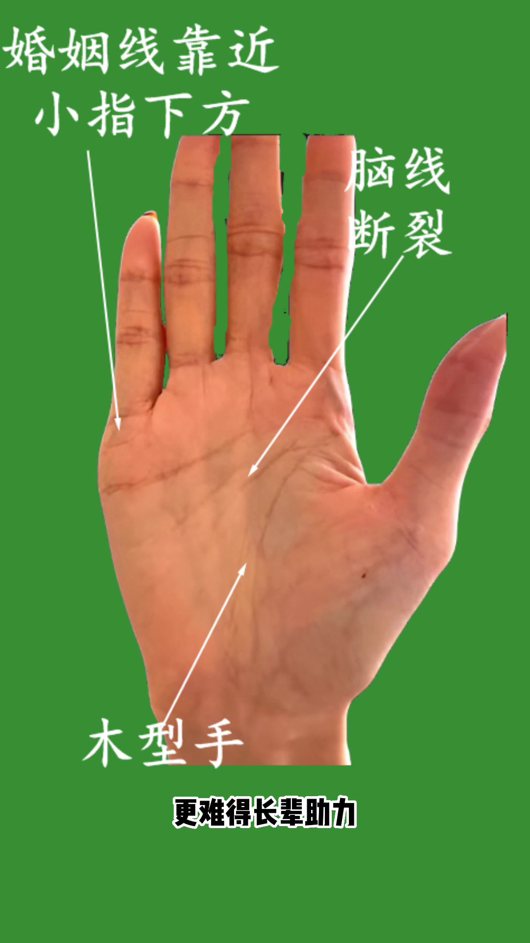 手如鸡爪六亲无靠