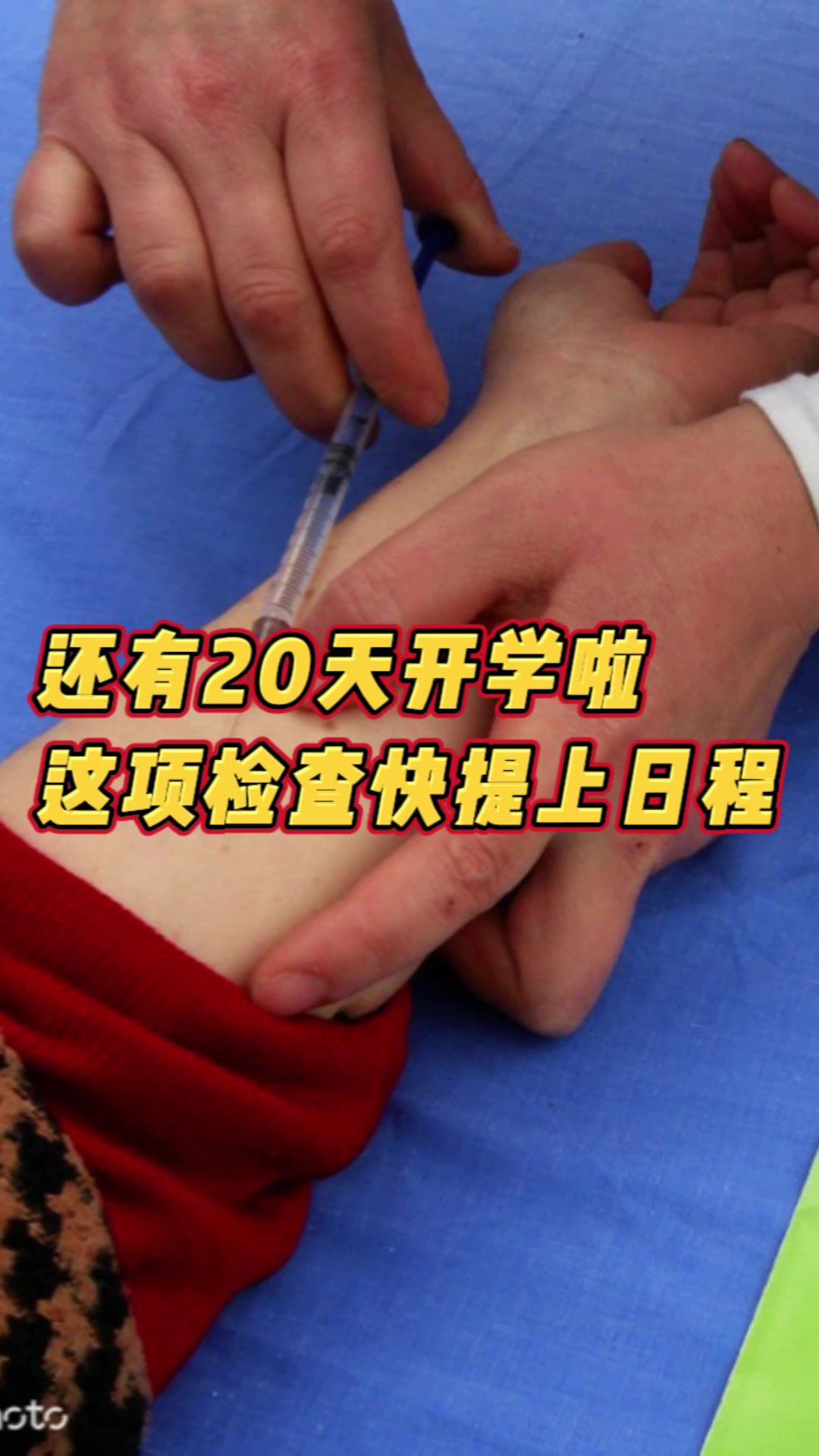 @家长,这份入学体检及PPD检查攻略请收好