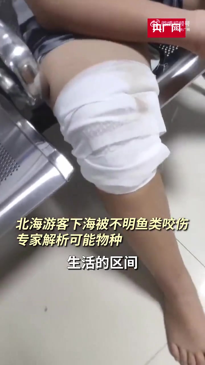 「专家称北海咬人鱼类或为鳗鲡类鲀类,还有这些海洋生物具有一定攻击性」据央广网,17日,广西