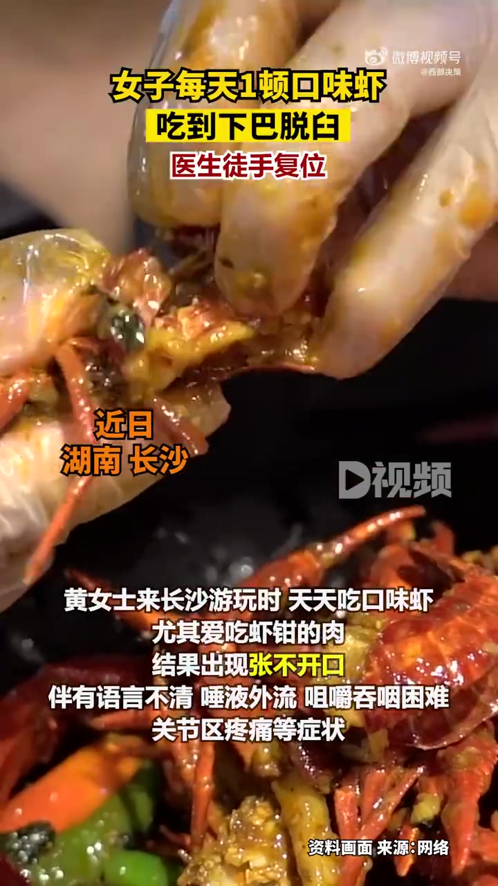 「女子每天1顿口味虾吃到下巴脱臼,医生徒手复位」近日,湖南长沙。一女子到长沙游玩,吃虾导致