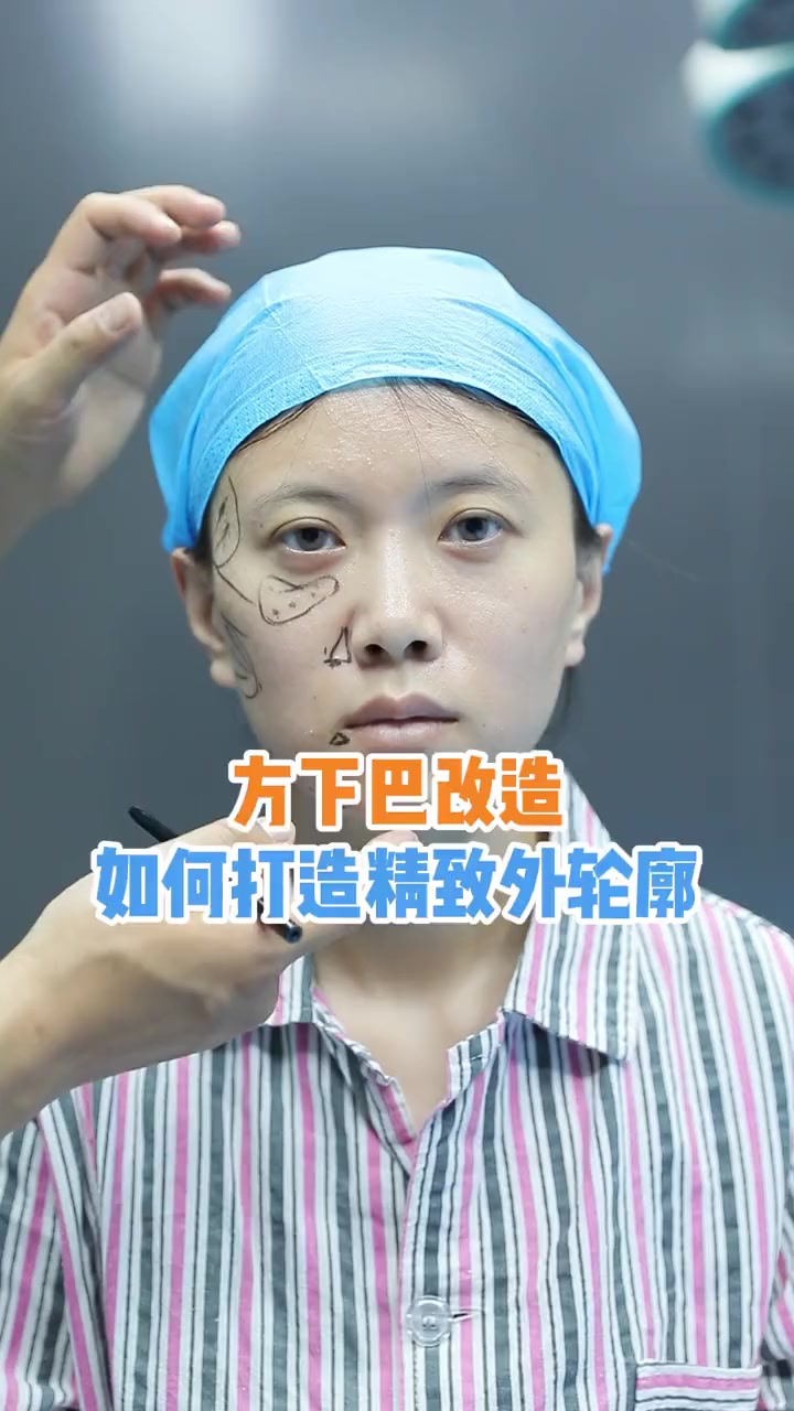 “屁股下巴”整改方案!拒绝男相感打造女性柔和美 丰下巴 方下巴 下颌线提升 面部轮廓塑型 