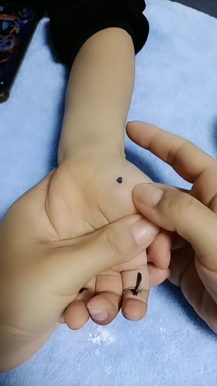 宝宝积食内热,鼻梁有青筋,一定要先清积食。家中常备山楂鸡内金,妈妈更省心!小儿推拿