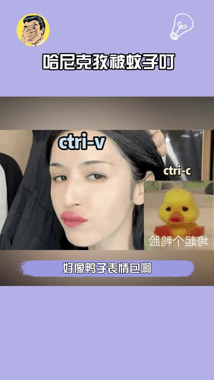 哈尼克孜 哈尼克孜被蚊子叮成香肠嘴