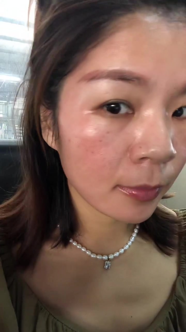 祛斑第27天。看着黑色素一点一点的排出,脸上也越来越干净了。
