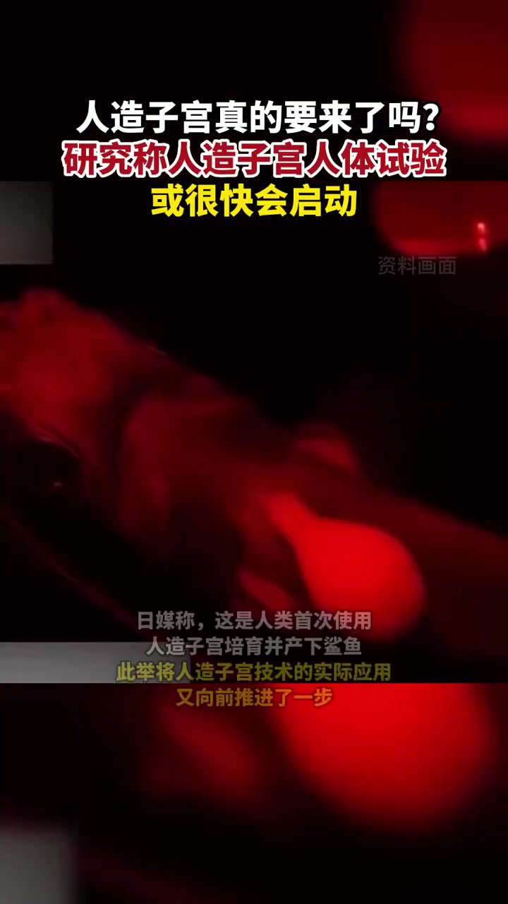「研究称人造子宫人体试验或很快会启动,人造子宫真的要来了吗?」你支持推广人造子宫技术吗 据