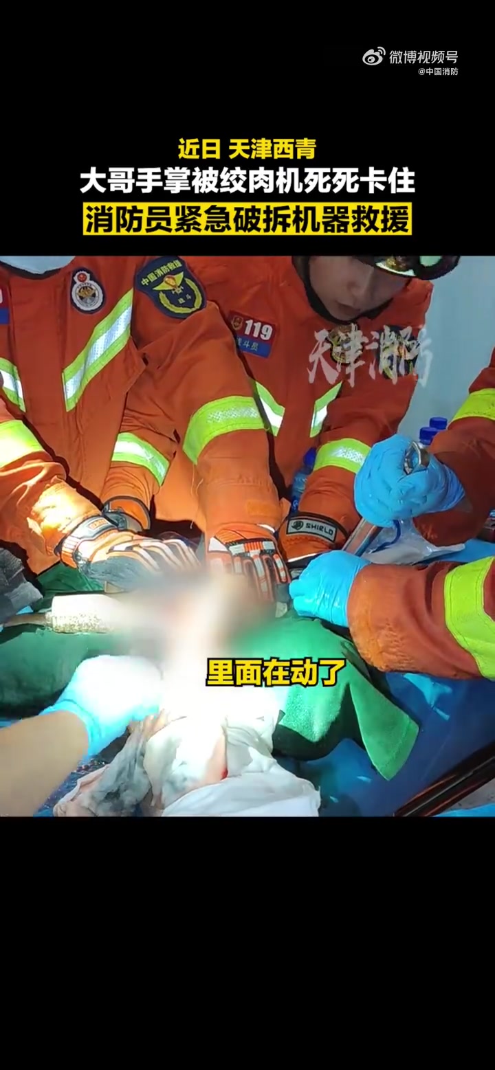 「当他快撑不住时消防员飞奔来救援」近日,天津西青,男子手被卷进绞肉机死死卡住,眼见血肉模糊