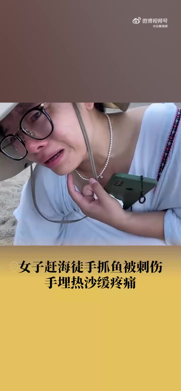 「女子徒手误抓毒鱼被刺手埋热沙缓痛:听本地人这样说的,手已经好了」你敢徒手抓鱼吗 近日,广