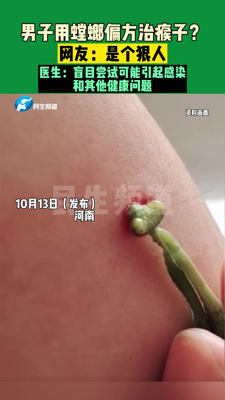 10月14日(发布)男子用螳螂偏方治瘊子?网友:是个狠人。医生:盲目尝试可能引起感染和其他