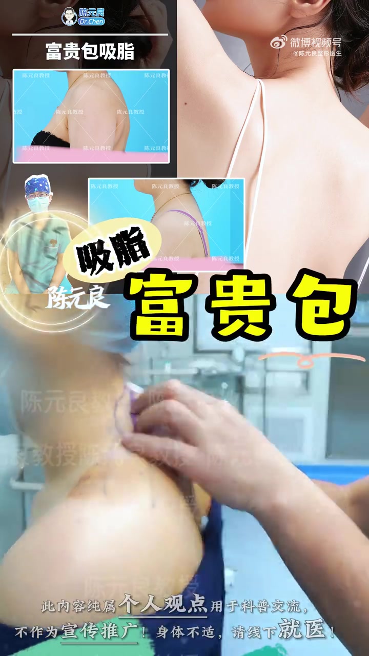 凸起的富贵包,容易造成周围肌肉紧张僵硬、关节紊乱,极易压迫神经和血管,出现局部酸胀、疼痛、