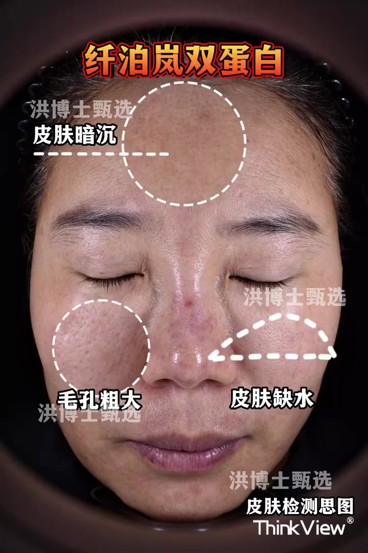 微博医美菁英大赏 改变就现在 纤泊岚  前段时间我在微博上,给大家分享了一个胶原蛋白领域的