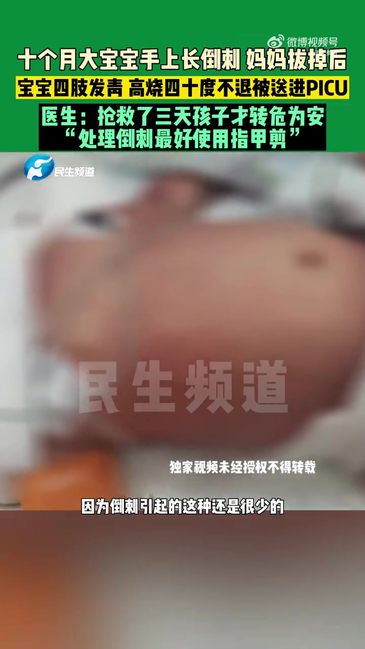 「第一次见这么严重的!10个月宝宝食指倒刺被拔送PICU抢救」10月18日(发布时间)河南