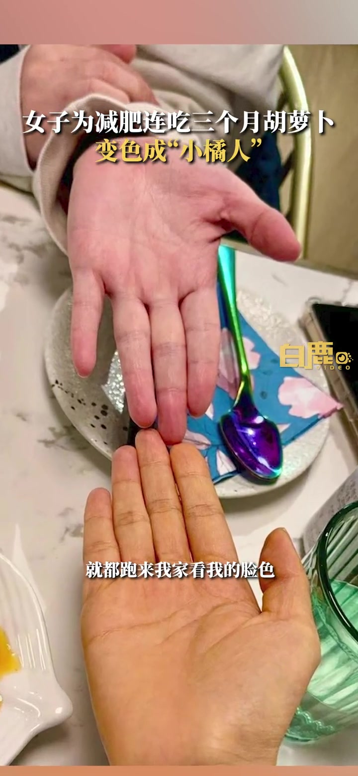 女子为减肥连吃3月胡萝卜变小橘人 减肥 社会