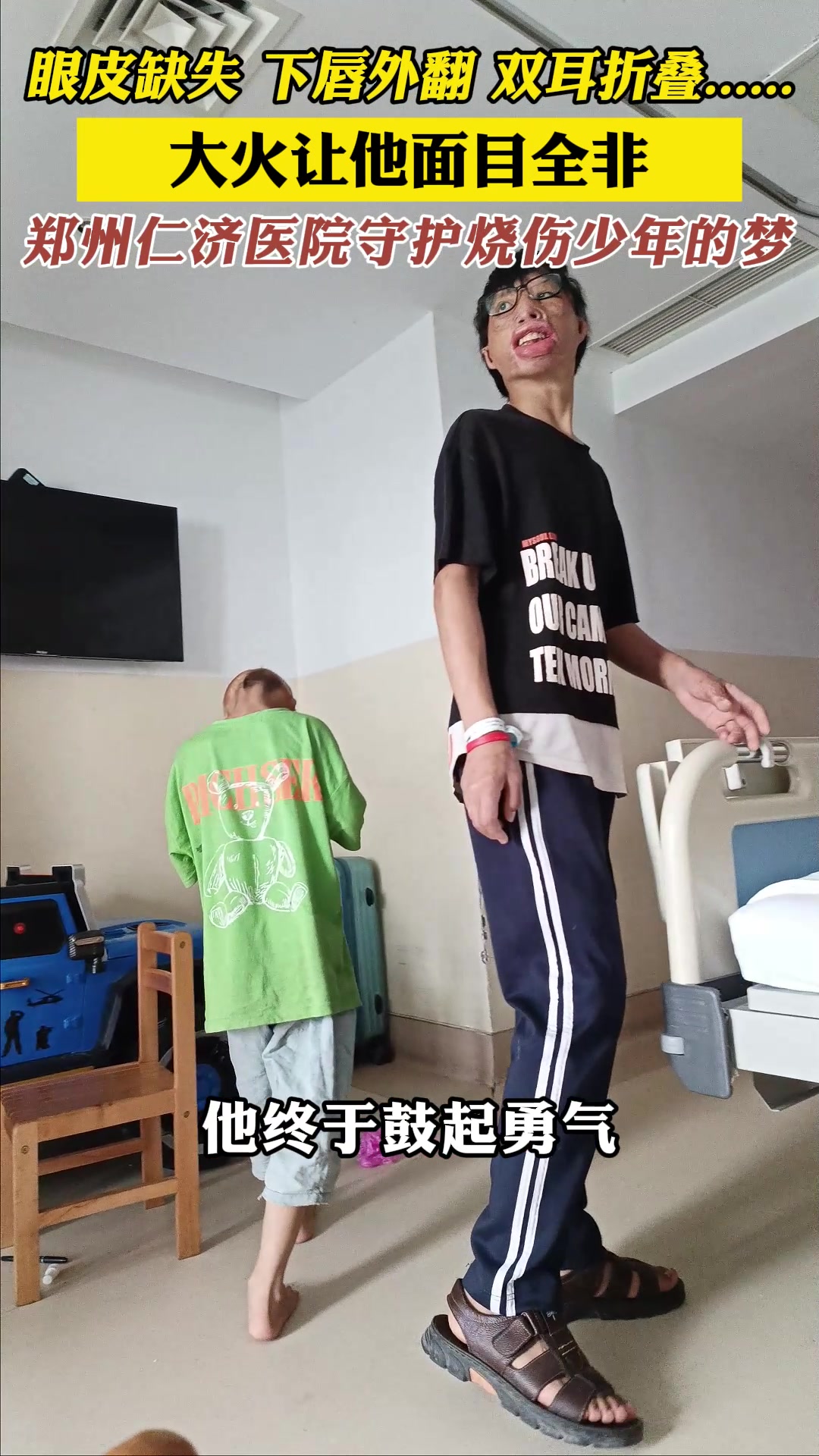 眼皮缺失、下唇外翻,大火让他面目全非,郑州仁济医院守护少年梦