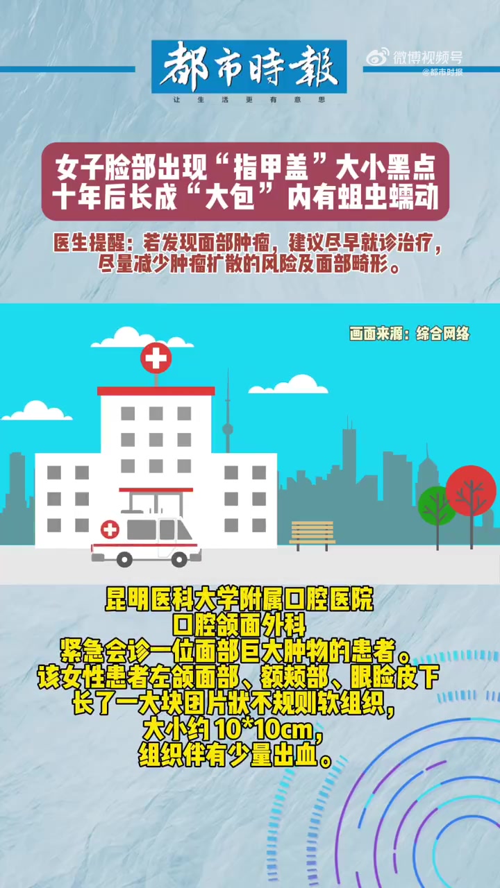 女子脸长黑点十年后变肿瘤「女子脸长巨大肿瘤内有蛆虫蠕动 医生提醒:出现这些症状别大意」近日