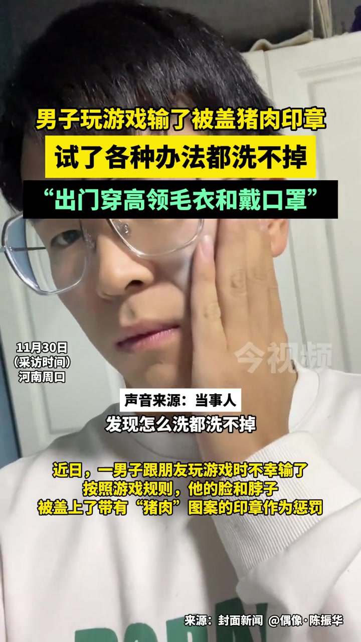 男子玩游泳输了被盖猪肉印章,试了各种办法都洗不掉:“出门只能穿高领毛衣和戴口罩”!男子 玩