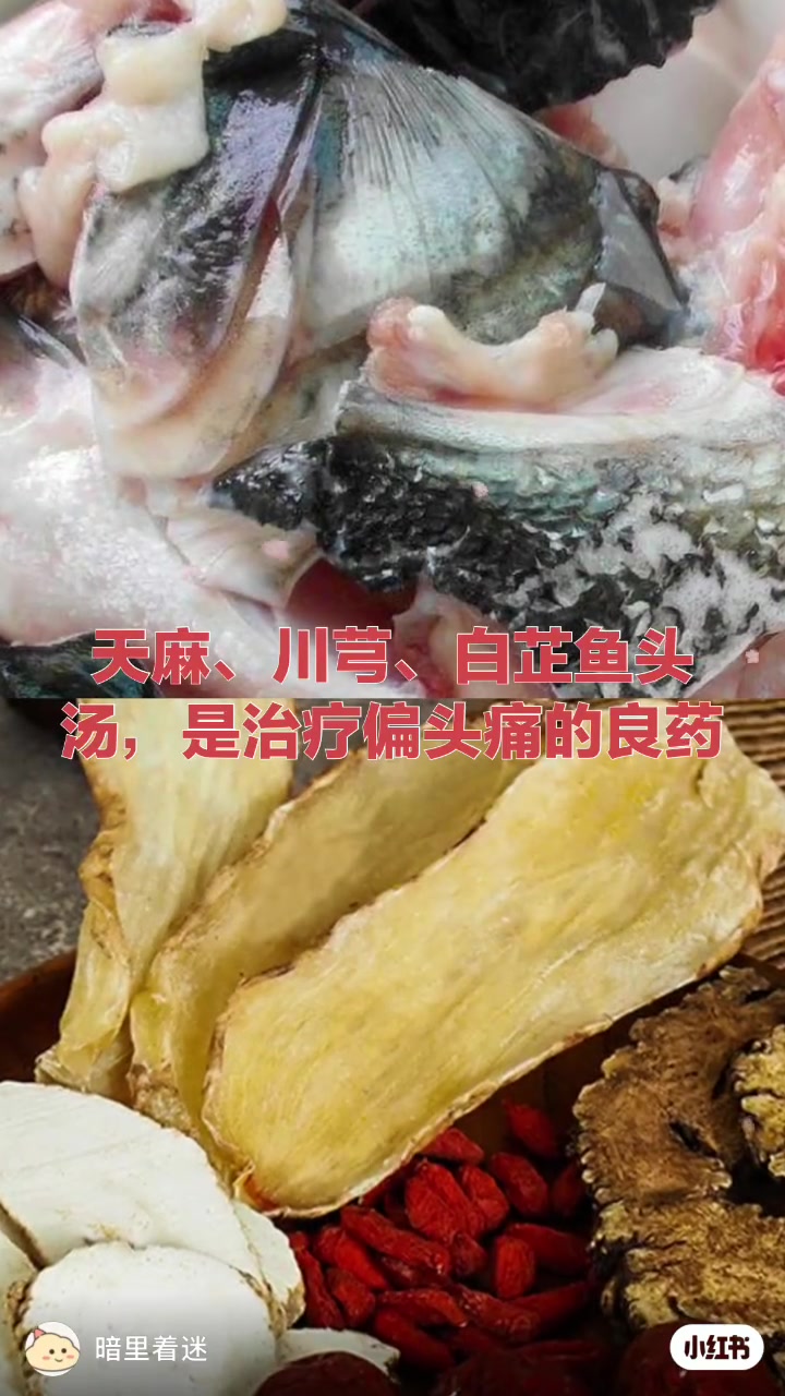 天麻川芎白芷鱼头汤治疗偏头痛的良方