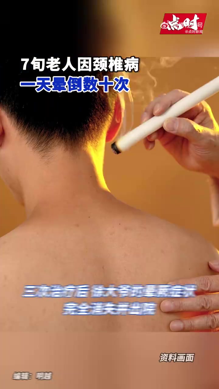 「7旬老人因颈椎病一天晕倒数十次」近日,浙江杭州,70岁的徐大爷一咳嗽就晕倒,而且每年都要