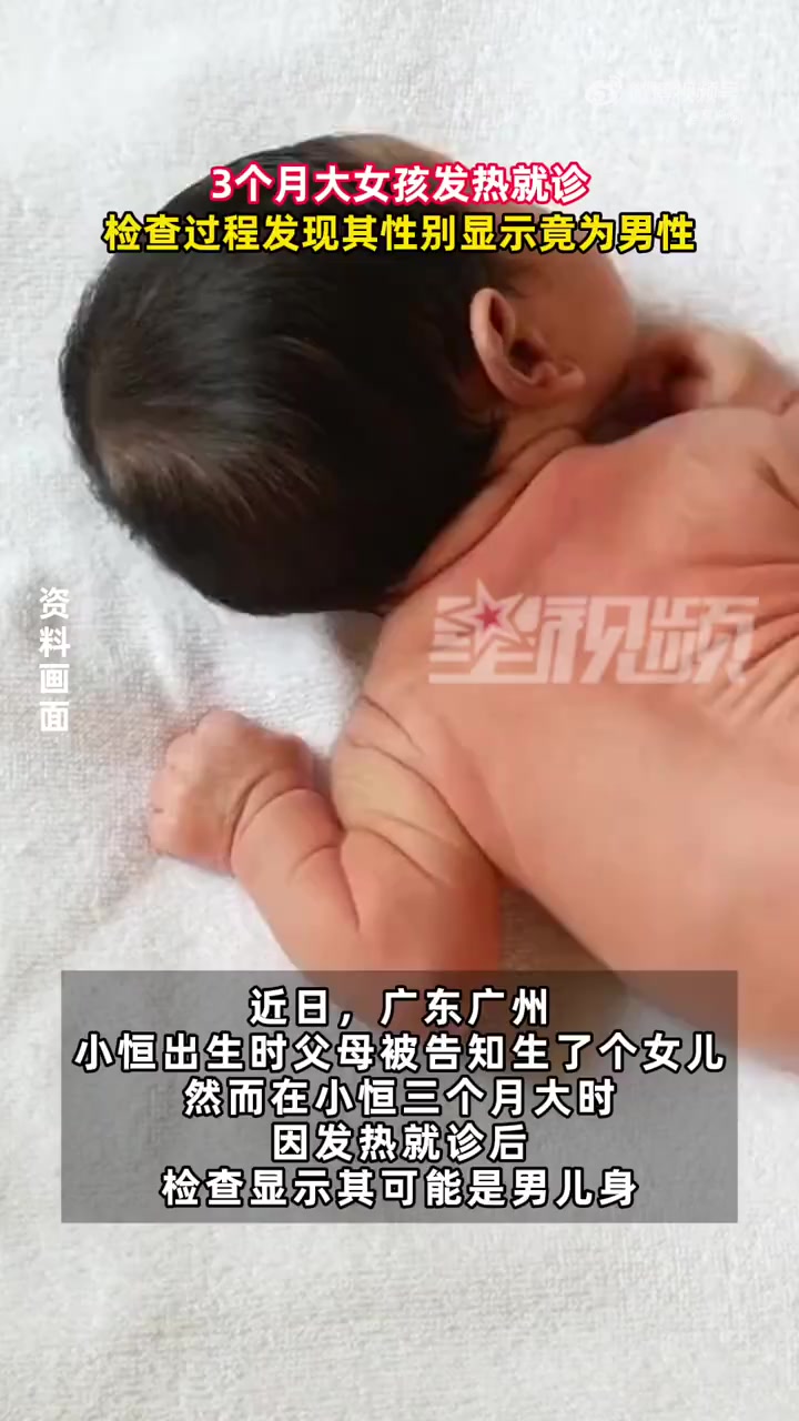 「3个月大女孩就诊发现是男儿身」近日,广东广州。小恒出生时,父母被告知生了个女儿。然而在小