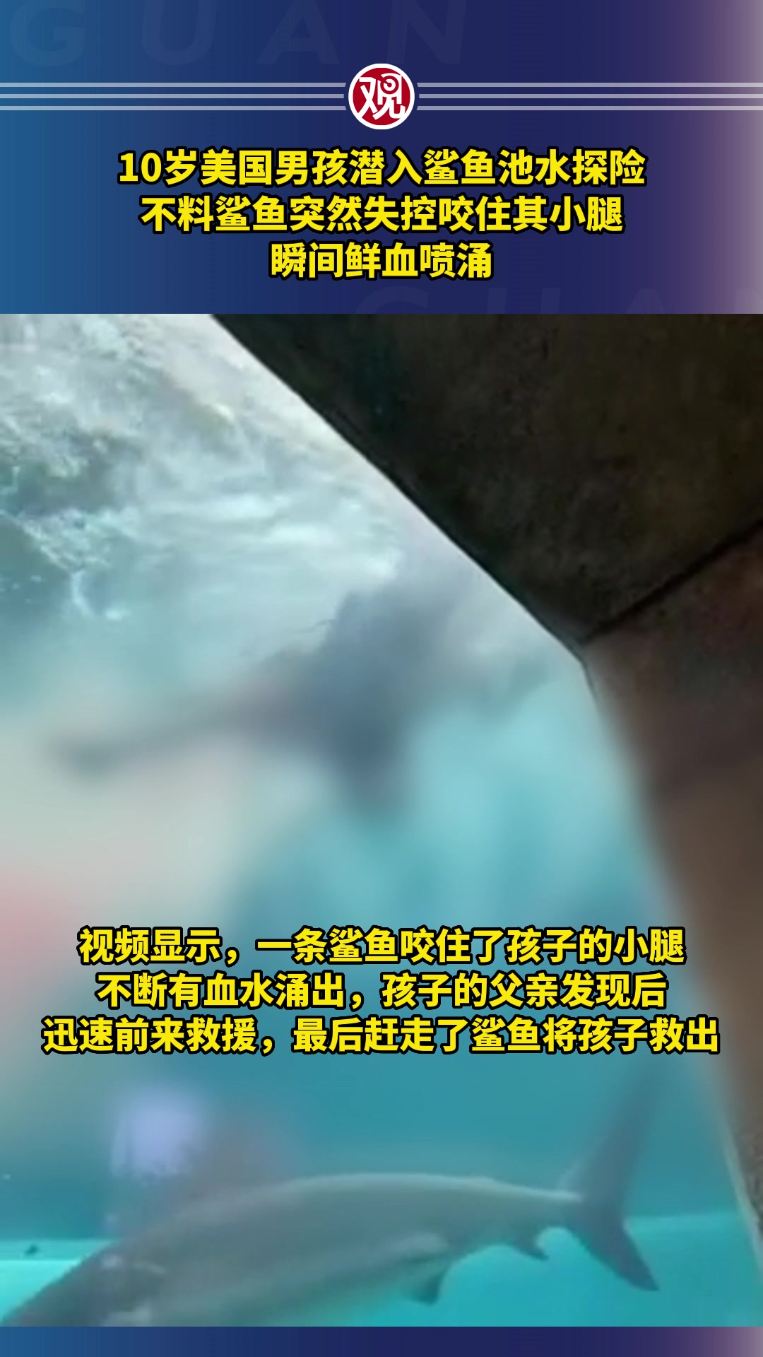 10岁美国男孩潜入鲨鱼池水探险,不料鲨鱼突然失控咬住其小腿,瞬间鲜血喷涌