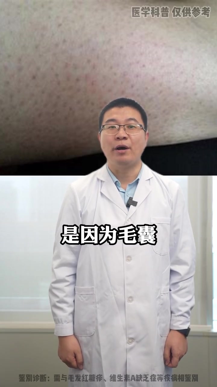 女性得了难以启齿的皮肤病?硬核健康科普行动 皮肤健康 鸡皮肤