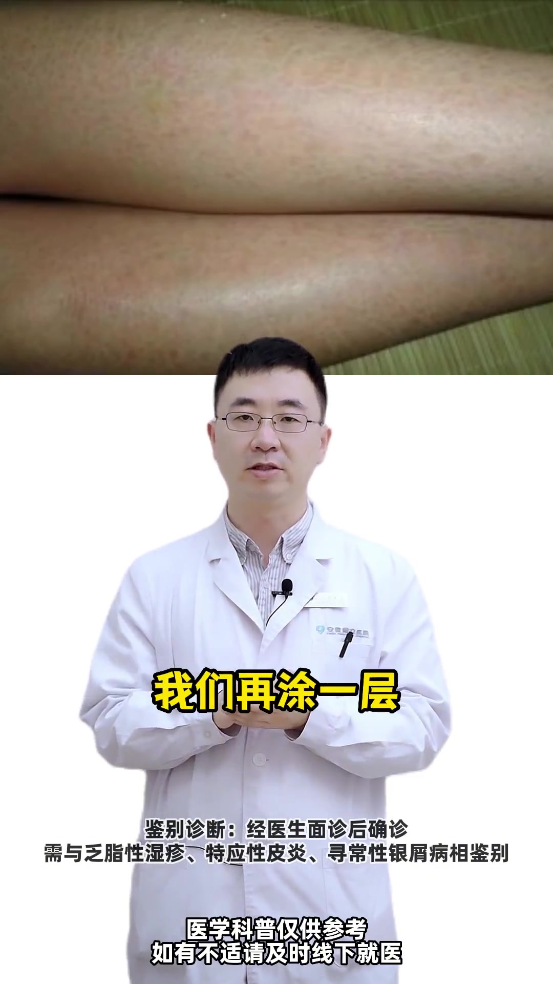 你的小腿是不是干燥像蛇皮?还有密密麻麻的小疙瘩,十分难看,这个视频告诉你怎么解决 鱼鳞病 