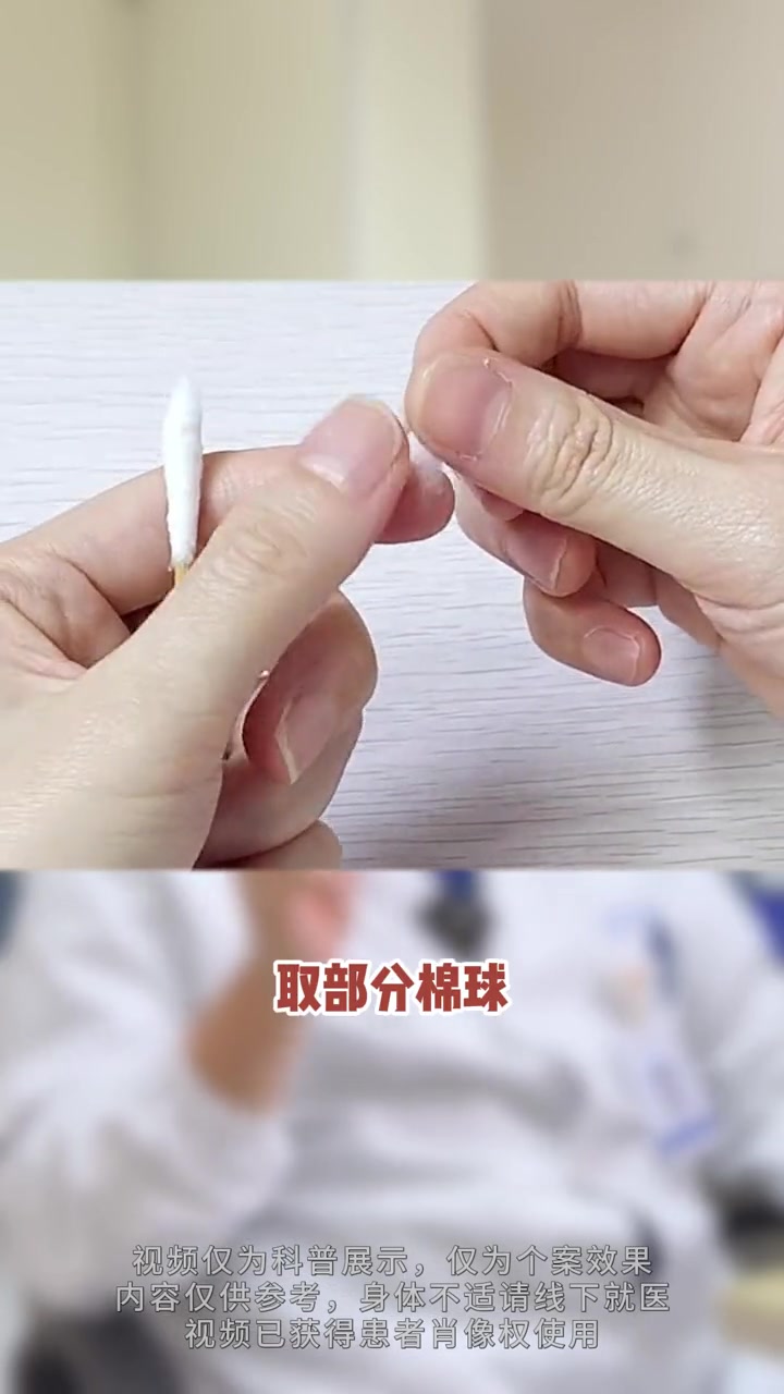 指甲总往肉里长,教你一步有效改善 甲沟炎 华东医院陈亮 嵌甲 指甲长肉里怎么办 医学科普