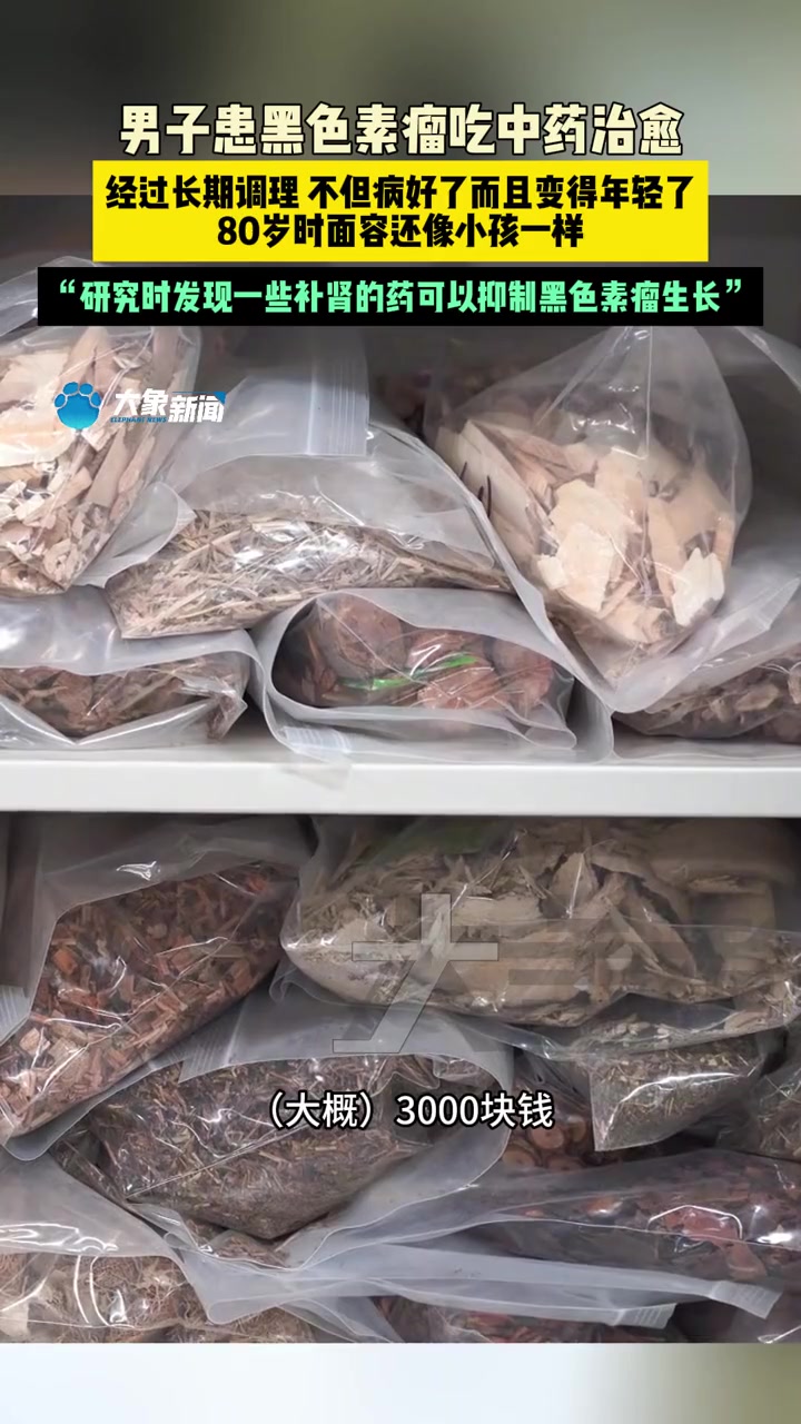 2月27日(发布),河南郑州,男子患黑色素瘤吃中药治愈,经过长期调理,不但病好了而且变得年
